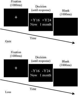 Use of Electroencephalography for the Study of Gain–Loss Asymmetry in Intertemporal Decision-Making